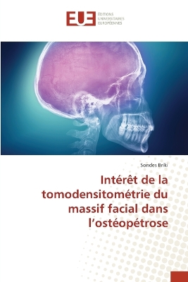 ibs